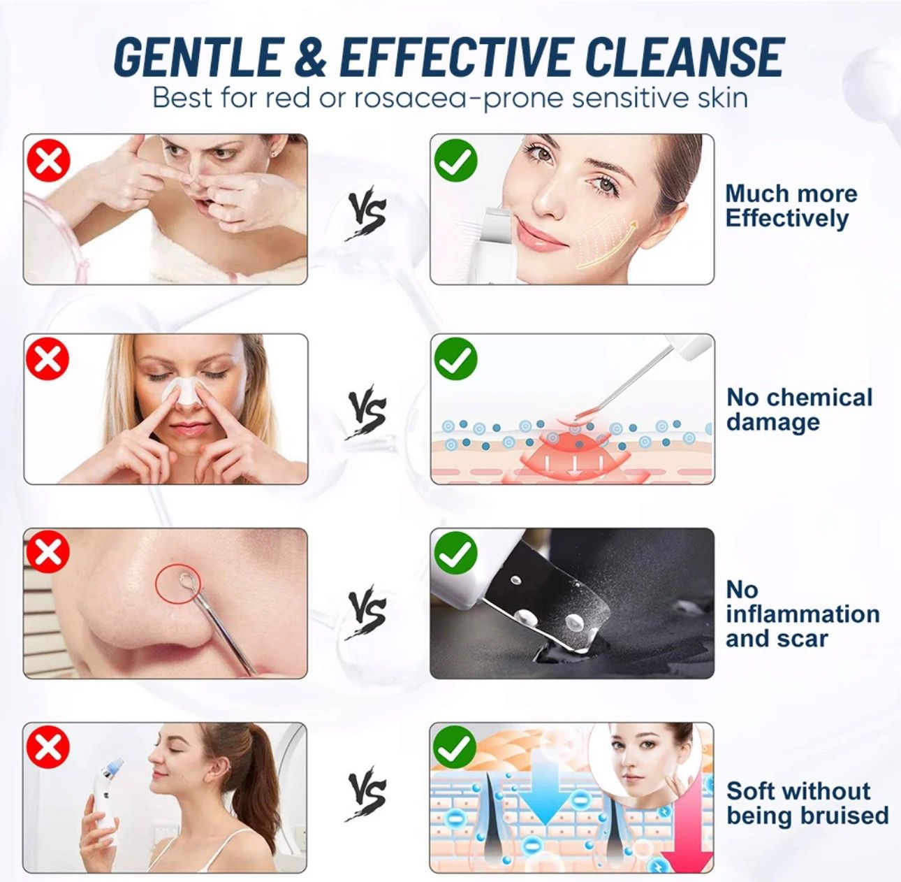 Kit para Facial y Remosion de puntos Negros